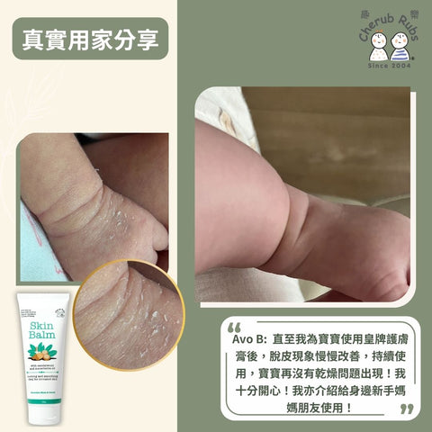 皮膚十分乾燥的Bb